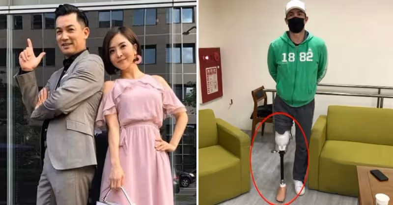 無預警公開截肢照！56歲男星伊正「右腳穿義肢」真的很痛，他現身「解釋現況」粉絲全含淚