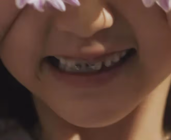 孫莉曬小女兒近照，9歲妹妹矯正大門牙引熱議，嘟嘴賣萌像黃磊