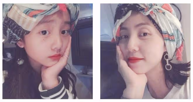 孫莉曬小女兒近照，9歲妹妹矯正大門牙引熱議，嘟嘴賣萌像黃磊