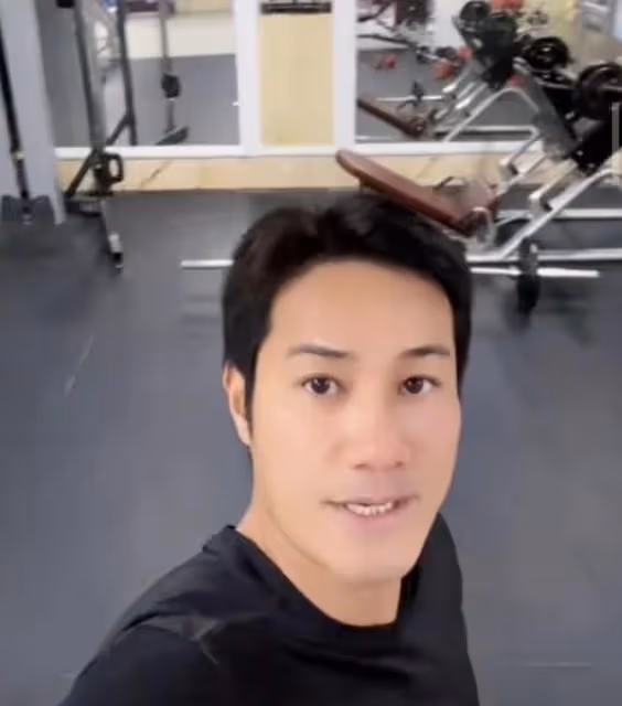 康復進度理想!香港知名男星內地遇襲重創險毀容,近況恢復光滑肌
