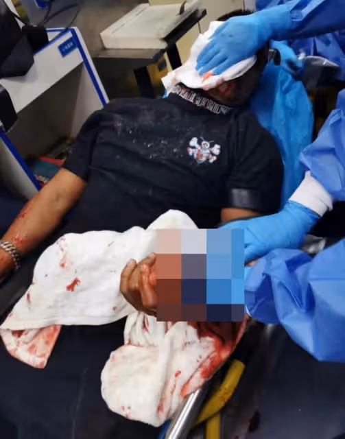 康復進度理想!香港知名男星內地遇襲重創險毀容,近況恢復光滑肌