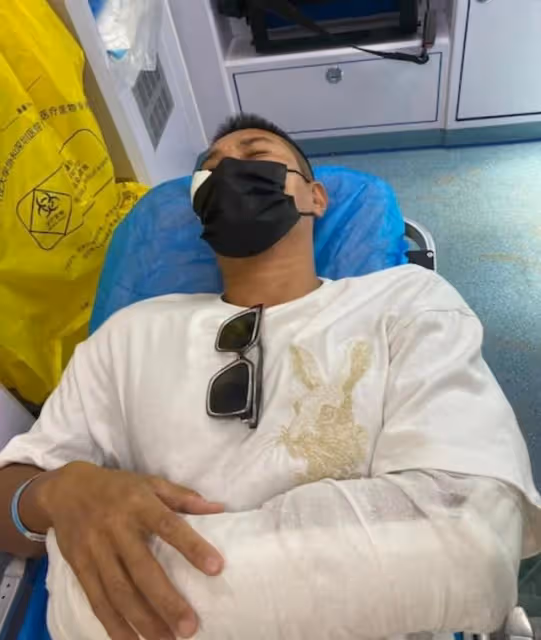 康復進度理想!香港知名男星內地遇襲重創險毀容,近況恢復光滑肌
