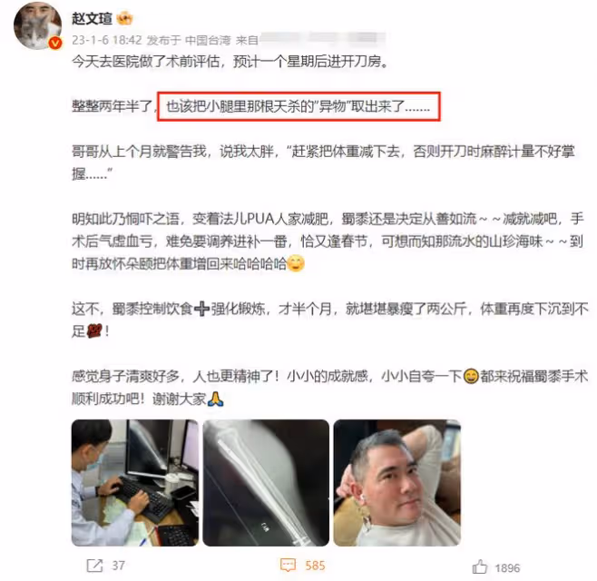 趙文瑄入院開刀取走異物！躺病床上手插針管，鬍子拉碴一臉憔悴
