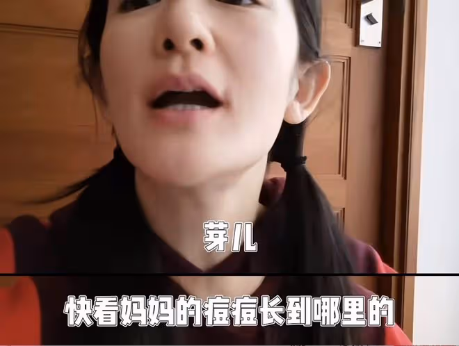 好機靈！謝娜長痘向女兒訴苦，1歲小咘芽一把抓住媽媽頭髮幫遮蓋