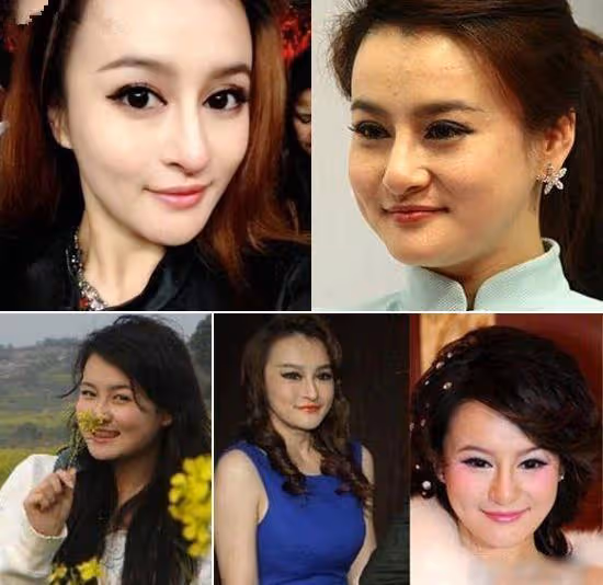 女星走紅毯猶如「照妖鏡」,誰在優雅老去,誰在瘋狂填充?