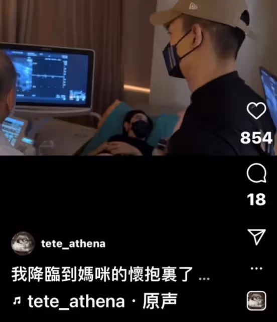 41歲許維恩宣布懷孕,曬B超公布女兒名字,經紀人回應:不是試管