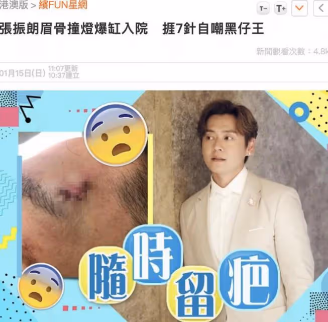 TVB演員張振朗拍戲出意外，眉骨被燈撞傷破相，送醫縫7針恐留傷疤