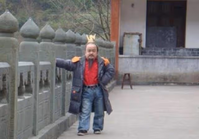 「小陰蝕王」張伸:身高1.15米,現無戲可拍,小18歲嬌妻揚長而去