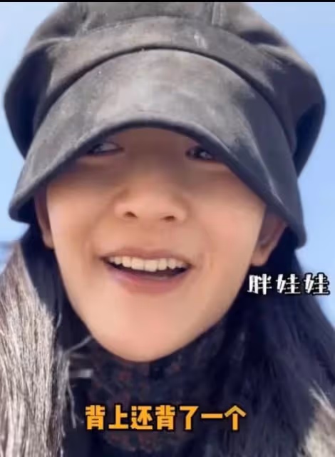 謝娜帶三女寶大鬧動物園，卻有眼尖的網友驚嘆：臉這是怎麼了？