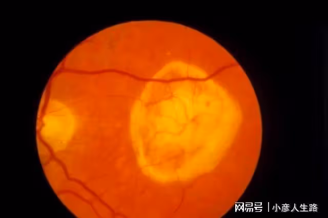 關於基因與人體健康的10個生理冷知識,你知道幾個?