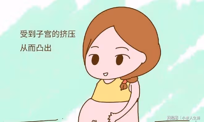 為什麼有些孕媽肚臍是凸出來,有些是凹下去的?