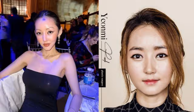 當年的脫北女孩朴研美竟成整形妖怪:新書將推出,封面照卻嚇壞網友