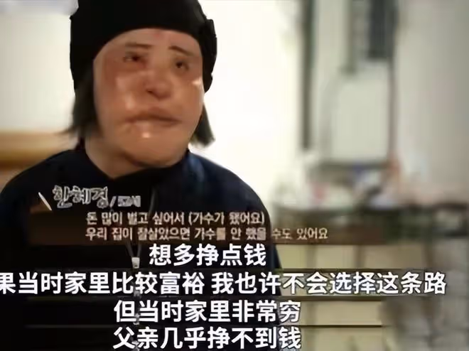 從「鏡子公主」到「電風扇臉」,韓慧景究竟經歷了什麼?
