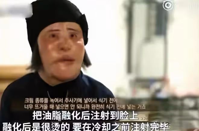 從「鏡子公主」到「電風扇臉」，韓慧景究竟經歷了什麼？