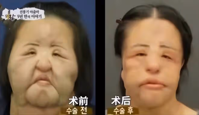 從「鏡子公主」到「電風扇臉」，韓慧景究竟經歷了什麼？