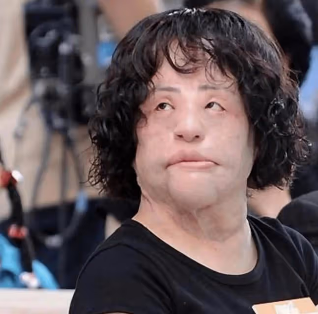 從「鏡子公主」到「電風扇臉」，韓慧景究竟經歷了什麼？