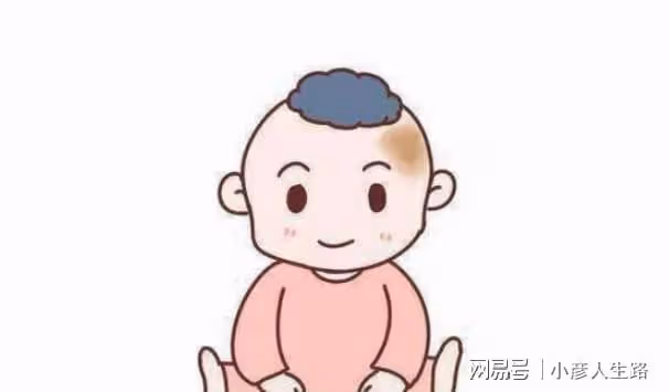 胎記怎麼來的?不想影響孩子的「顏值」,孕期要做好這3點