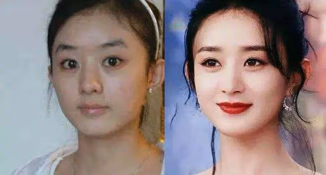 明星看似光鮮亮麗,在失去美顏濾鏡後,其實也跟普通人相差無幾