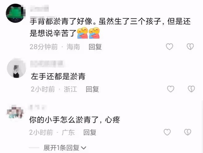 鄭嘉穎嬌妻產後做月子餐手部淤青,塗指甲妝容精緻,31歲已生3子