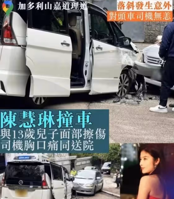 50歲陳慧琳車禍1個半月,臉未消腫仍疼痛,堅持復工穿抹胸秀身材