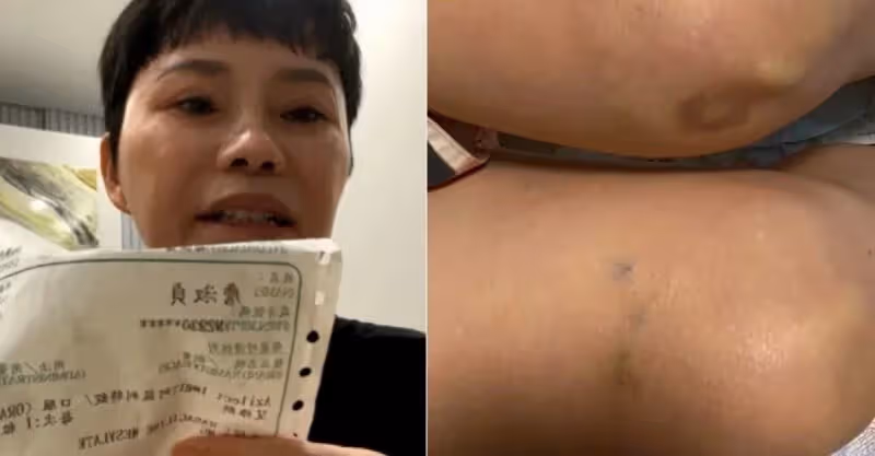 才爆被騙3千萬！詹雅雯突然PO「驚悚瘀青照」嚇壞粉絲　悲嘆「病體已經無能為力」：我還能活多久？