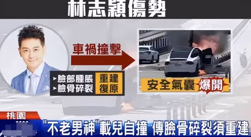林志穎車禍後復出在即,現身公司宣傳建築項目,臉頰未留疤痕無瑕疵