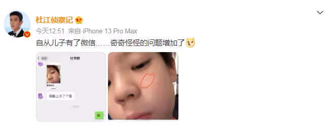 杜江兒子近況曝光,9歲嗯哼自疑長青春痘,父子倆對話太好笑