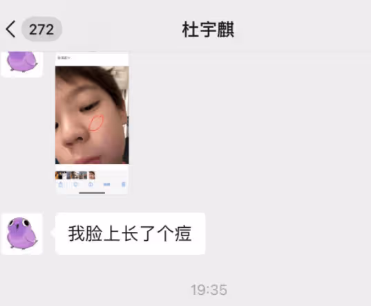 杜江兒子近況曝光,9歲嗯哼自疑長青春痘,父子倆對話太好笑