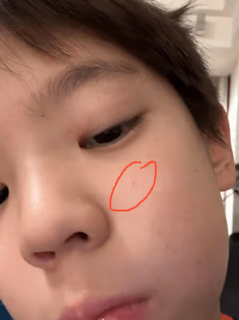 杜江兒子近況曝光,9歲嗯哼自疑長青春痘,父子倆對話太好笑