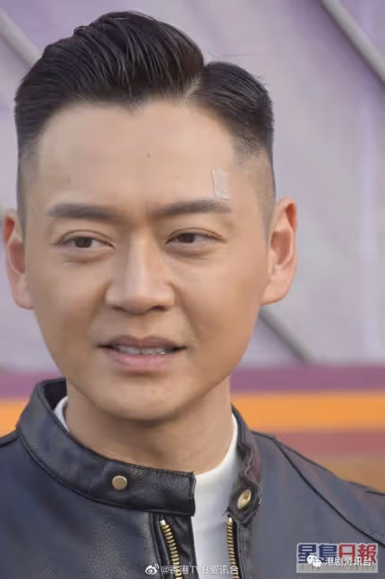 張振朗撞爆頭後首現身!找整容醫生縫針堅稱純天然