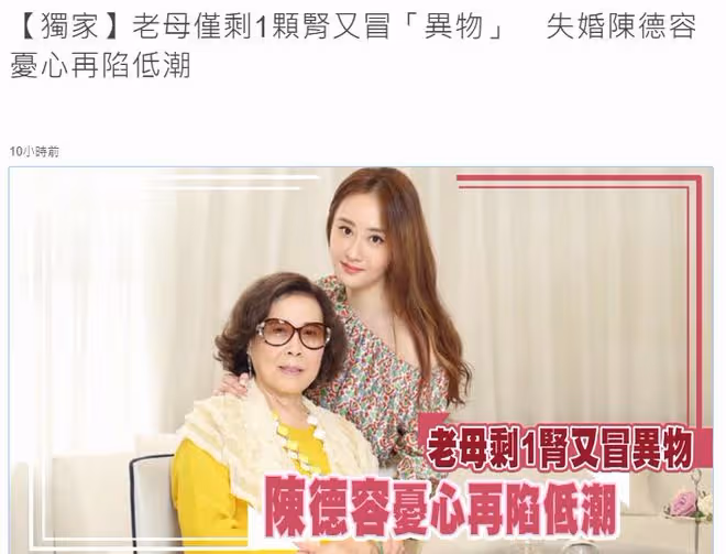 48歲陳德容被曝染重症,本人急曬近照澄清,稱感冒引發過敏而已