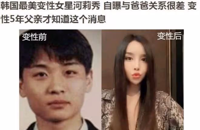 韓國最美變性人河莉秀,為愛甘願變性,卻因不能生育慘遭老公拋棄!