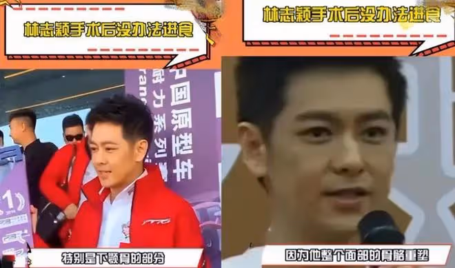 林志穎車禍後首次帶家人出國,比kimi瘦一圈,曾經歷3個艱難時刻