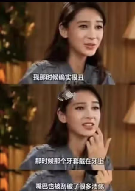 baby現身老態盡顯蘋果肌下滑嚴重人中變得更長了，沒想到八千萬的臉也「垮」了