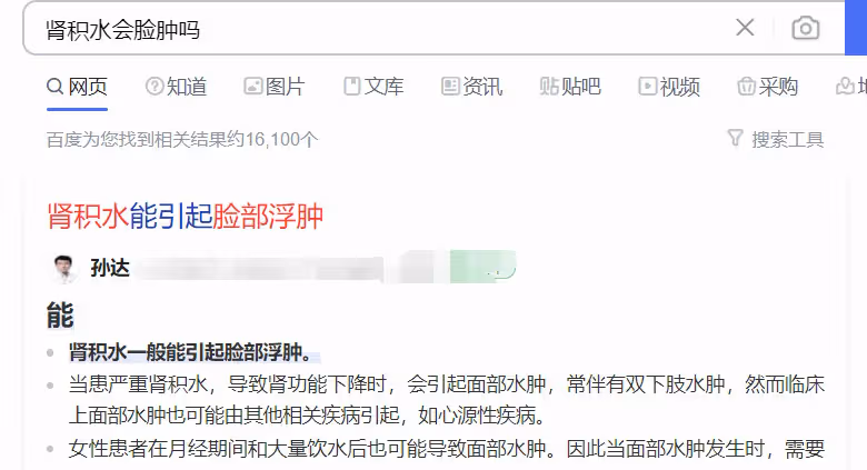 《狂飆》導演稱吳剛臉腫並非整容，全網欠吳剛一個道歉