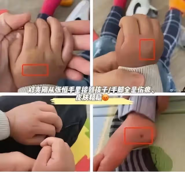 鄭爽虐童事件升級!張恆再曝2個關鍵證據:滾進監獄吧!