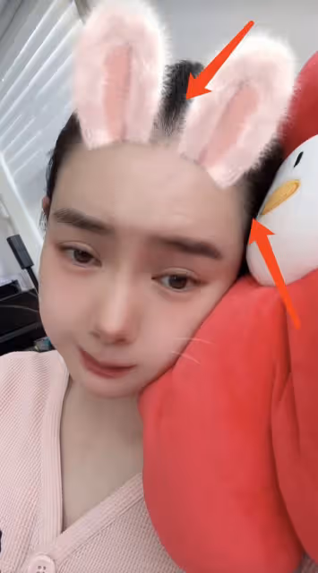 戚薇產後未瘦至90斤壓力大,脫髮嚴重頭皮清晰可見,髮際線上移