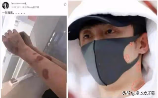 懷孕？家暴，出軌，包養！黃景瑜負面不斷，前女友顏值高過熱巴。