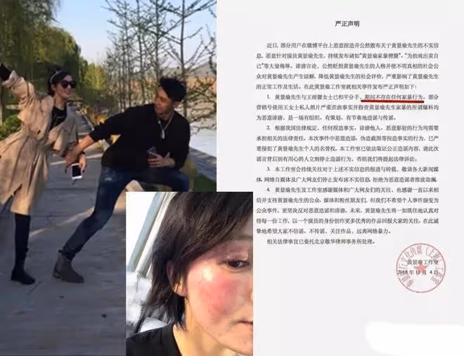 迪麗熱巴黃景瑜後續,曝兩人戀愛4年,王雨馨承認和黃景瑜離過婚