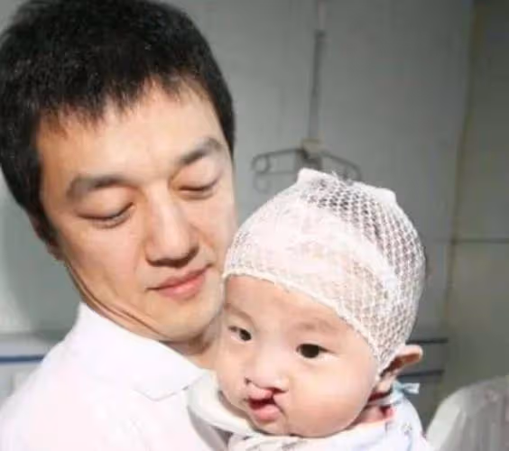 李亞鵬:小女兒眼睛似有問題,網友紛紛勸他趕緊去看醫生好心酸
