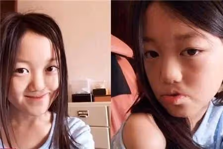 李亞鵬:小女兒眼睛似有問題,網友紛紛勸他趕緊去看醫生好心酸
