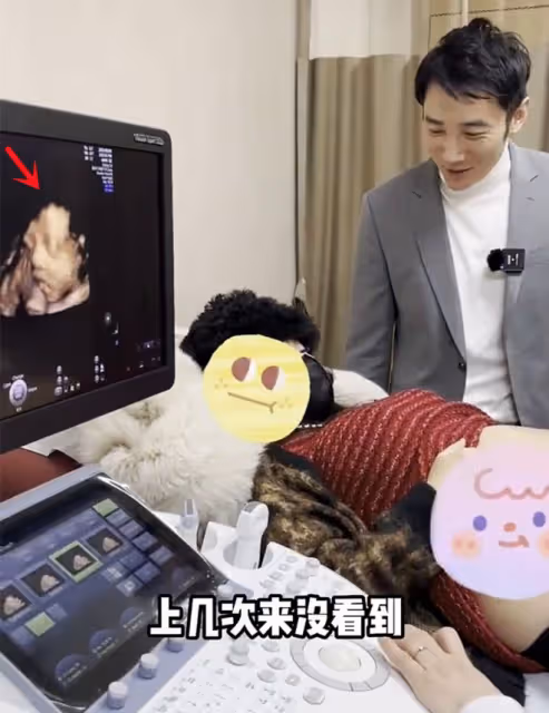 白冰前夫已再婚,帶嬌妻產檢超恩愛,寶寶四維圖曝光鼻子像爸爸