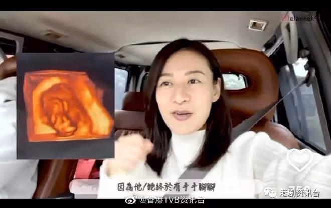 懷孕5個半月出活動！江若琳被老公笑老蚌生珠