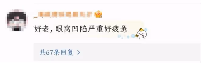 謝娜自曝產後瘦20斤，素顏出鏡瘦成紙片人，眼窩凹陷顯疲態