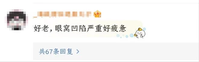 謝娜自曝產後瘦20斤,素顏出鏡瘦成紙片人,眼窩凹陷顯疲態