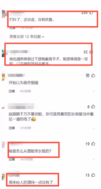 趙麗穎最新照滿臉膠原蛋白回到花千骨，說話嘴巴難張開被說太僵硬