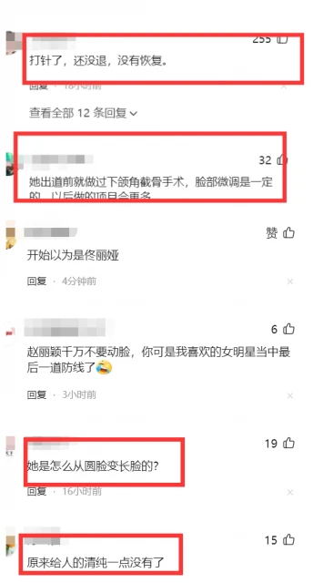 趙麗穎最新照滿臉膠原蛋白回到花千骨,說話嘴巴難張開被說太僵硬