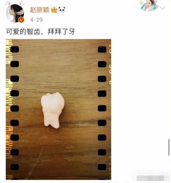 趙麗穎最新照滿臉膠原蛋白回到花千骨,說話嘴巴難張開被說太僵硬