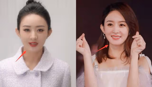 4位女明星整容失敗？楊紫像發麵饅頭，趙麗穎臉僵說話不自然