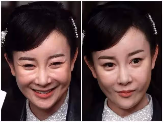 4位女明星整容失敗？楊紫像發麵饅頭，趙麗穎臉僵說話不自然
